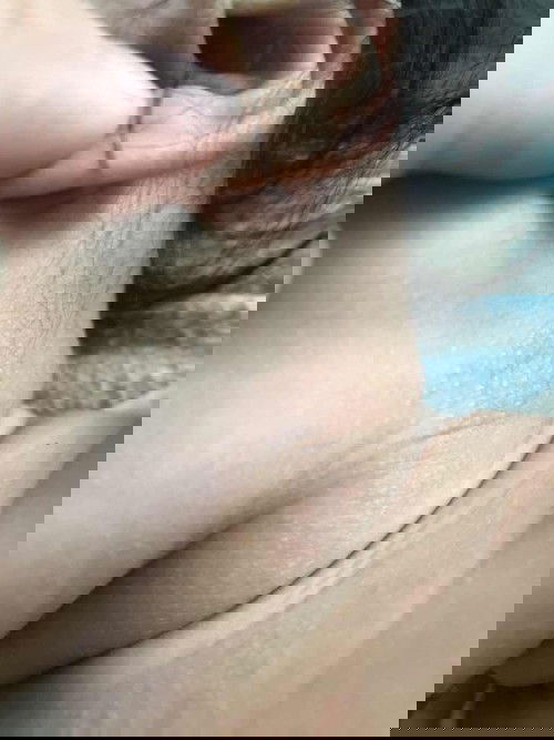 Bé nhà em dc 5m25d bị nổi ở cổ ntn ? Là bị làm sao v mng 🥲