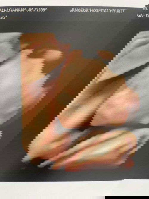 สาวน้อยบ้านนี้ทีม มิถุนาค่ะ บ้านไหนลูกสาว ลูกชาย กันบ้างค้า :)