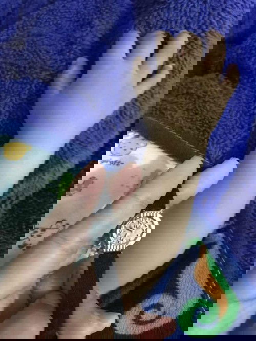 kulit bayi belang krna mmkai jam tangan