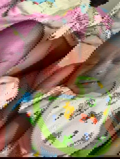 เป็นผื่นเเดง คือไร