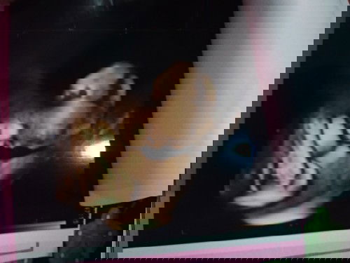 Bun saya mau tanya? Saya sudah 7bulan kok pergerakan bayi nya kurang bergerak atau kurang lincah ya?