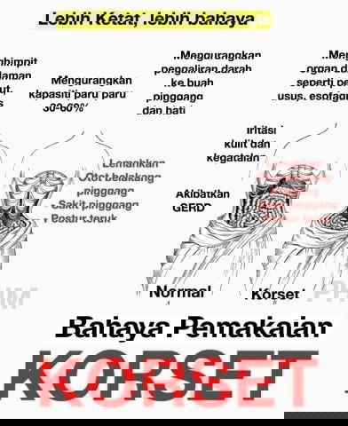 bahaya pemakaian korset