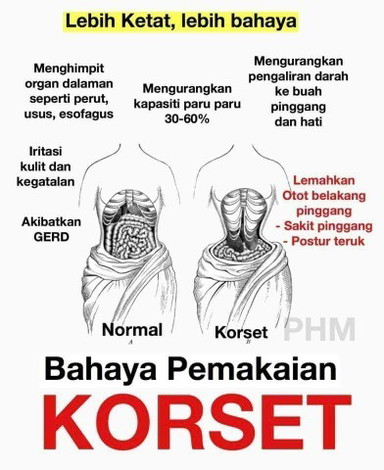 bahaya pemakaian korset