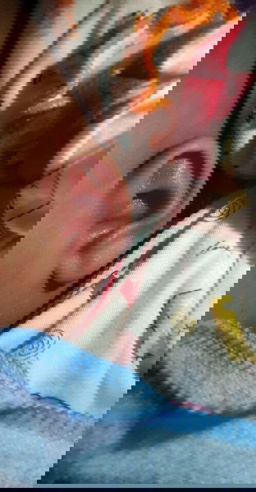 กลัวว่าน้องจะมีปัญหาเรื่องหู