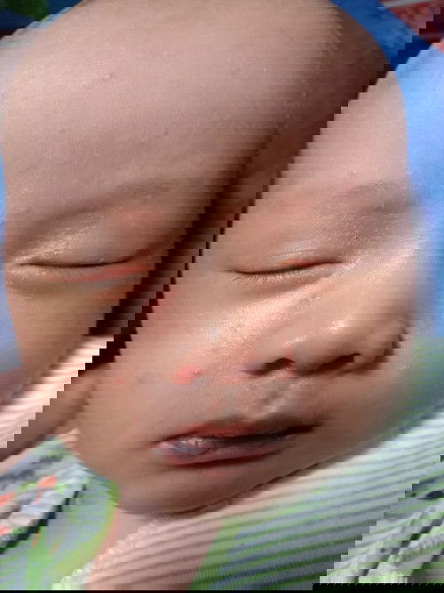 Muka baby bintik-bintik merah