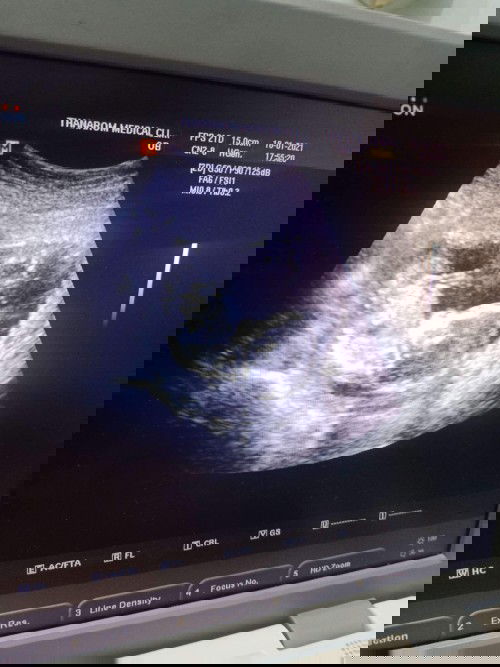 ตอนนี้17w1dแบบนี้ตัวใหญ่มั้ยคะ