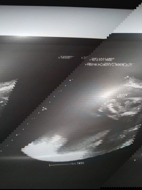 It's a Baby boy ❤️👶 
Ano kaya magandang name ? Pa comment ako mga momsh 😊