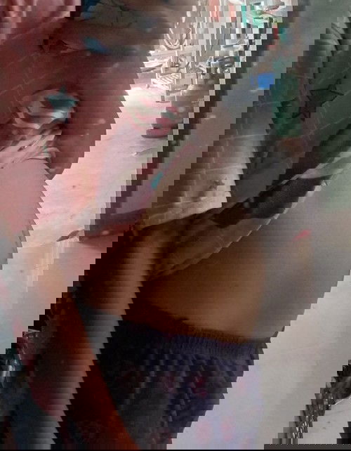 20week+อยากรู้ว่าผู้หญิงหรือผู้ชายคะท้องแบบนี้