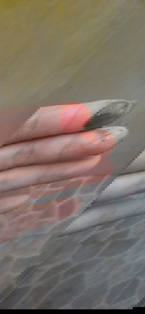 Pendarahan saat masuk 10week