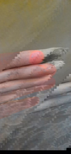 Pendarahan saat masuk 10week