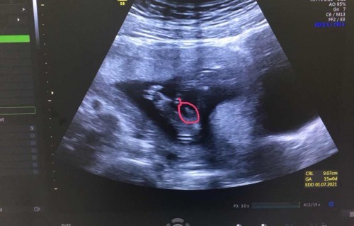 บ้านไหน ได้ลูกชายบ้างคับ แม่ๆ