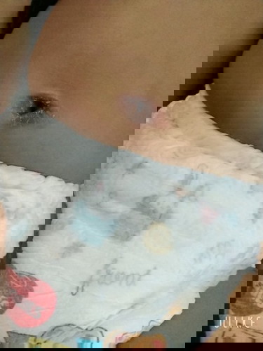 Pusat baby kering/melecet
