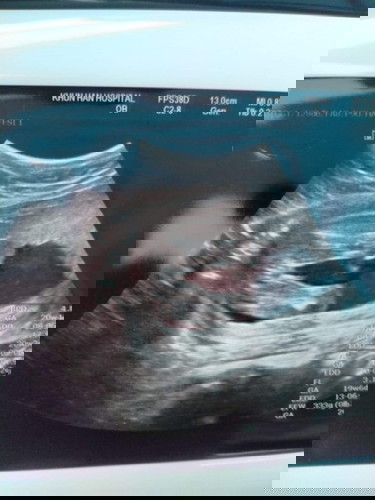 เพศอะไรค่ะของสอบถามหน่อยค่ะ