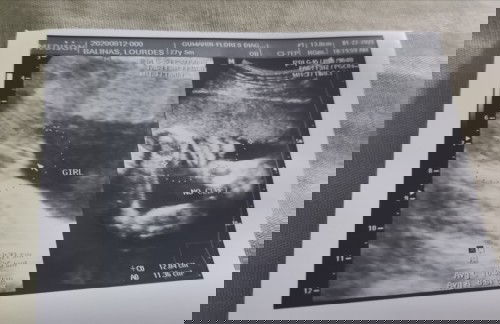 Ultrasound pic