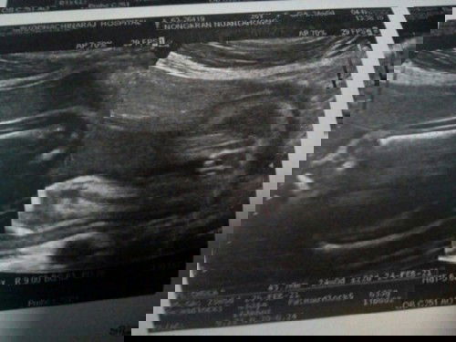 แม่ๆช่วยดูให้หน่อยจ้า