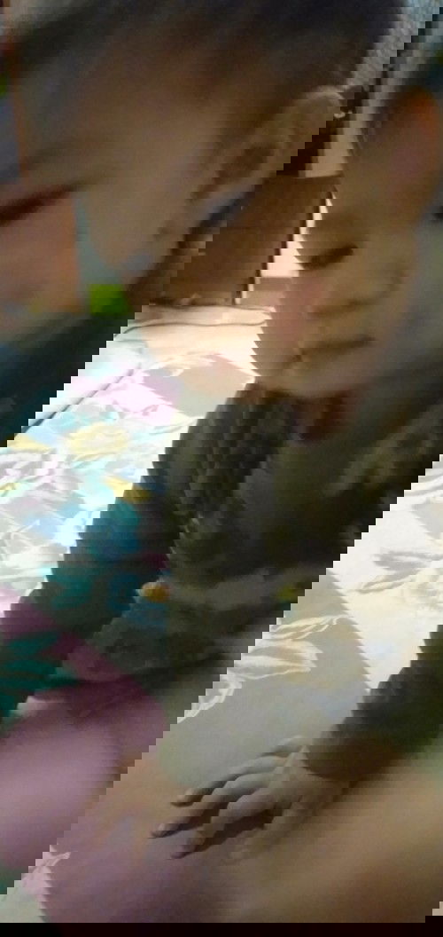 วิธีรักษากากน้ำนม