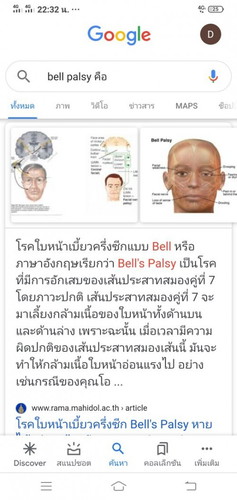 มีคุณแม่คนไหนเคยเป็นโรคนี้ตอนตั้งครรภ์มั้ยค่ะ ตอนนี้เราตั้งครรภ์ได้36w