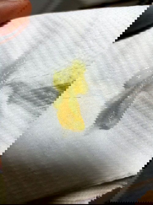 36w 4d อยากทราบอาการเตือนจะคลอด