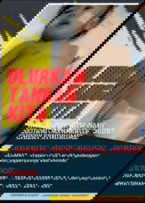 BUDD CHIERY SYNDROME