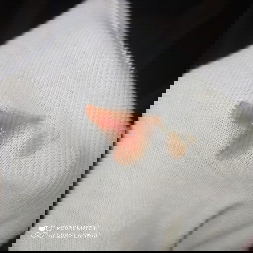 Implantation bleeding or Menstruation?