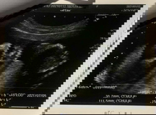 อวัยวะเพศแบบนี้ ผู้ชายหรือผู้หญิงคะ แม่ๆคนไหนดูออกช่วยคอมเม้นแสดงความคิดเห็นหน่อยนะคะ