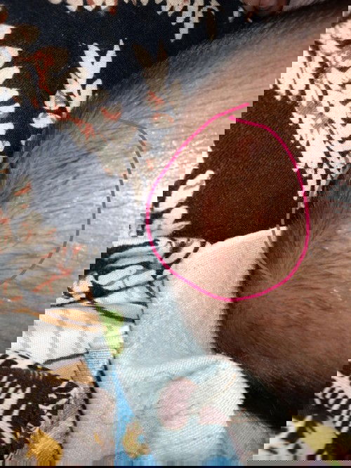 bentol dikepala bayi