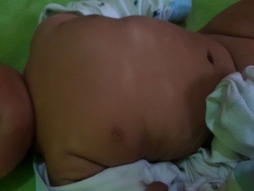 Sino naka experience nito sa skin ni bby?