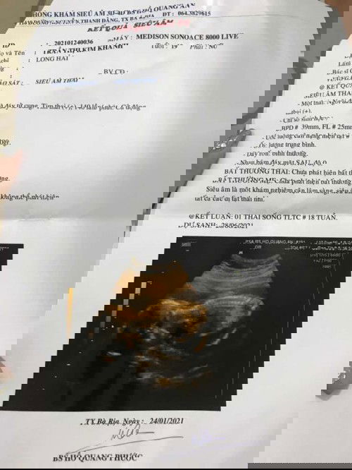 Tham khảo ý kiến