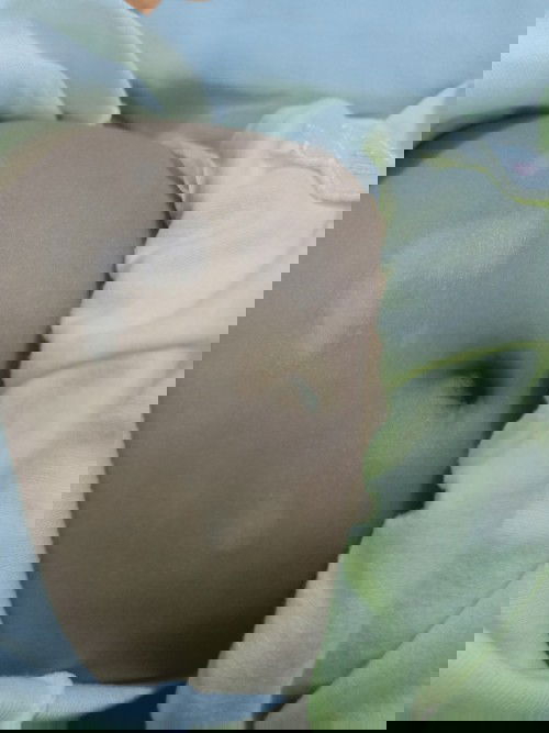 Bercak putih perut bayi