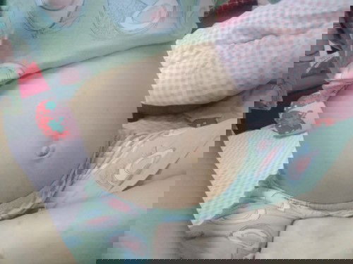 23w แล้วจ้าแต่ยังไม่รู้เพศเลย😁😁