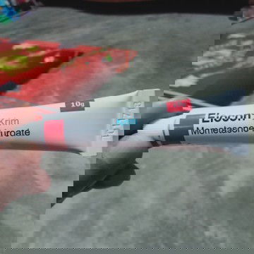 Tentang kehamilan dan obat gatal