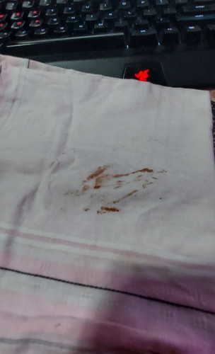 Spotting is it normal?