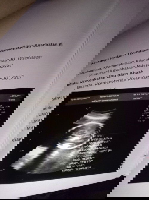 Beda prediksi bidan Sama USG