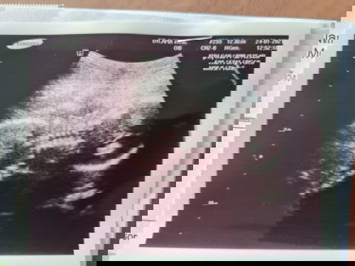 ตอนนี้หนู 21 สัปดาห์ แล้วจ้า