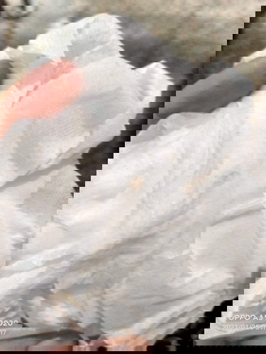 มีอาจท้องแข็งบ่อยด้วยค่ะ