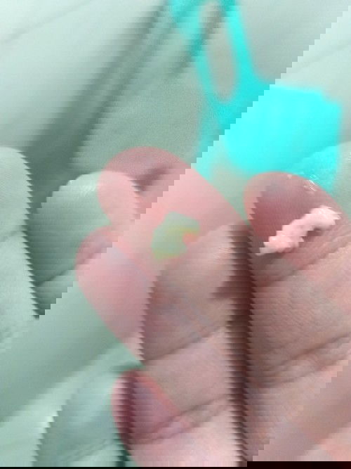 Yellowish discharge at 36weeks