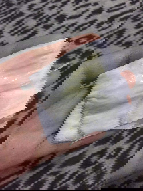 ถามแม่ๆหน่อยค่ะ ตอนนี้กังวลมากเลย