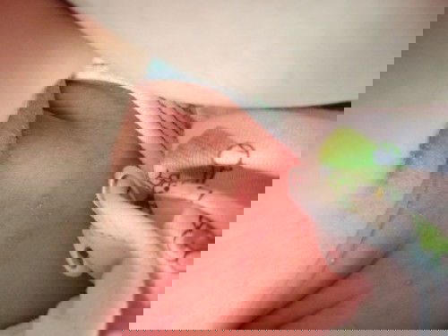 เป็นตุ่มขึ้นแบบนี้อันตรายไหมคะ