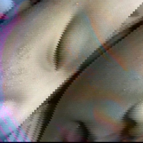 Bintik bintik kecil putih