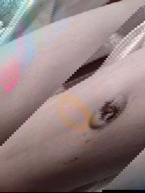 Mom cho e hỏi về rốn con