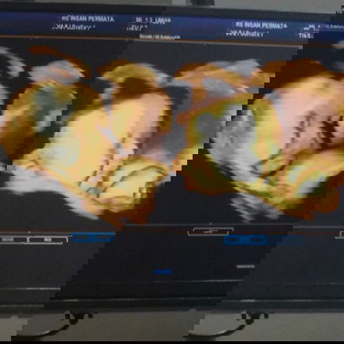 our little angel🥰