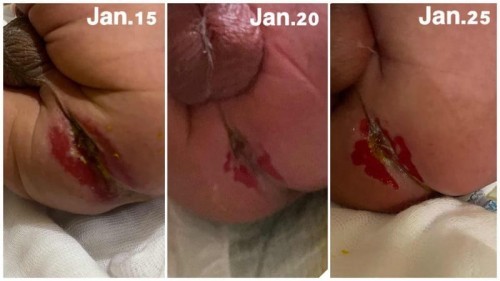 Help. Gusto ko nang gumaling ang baby ko. Huhu