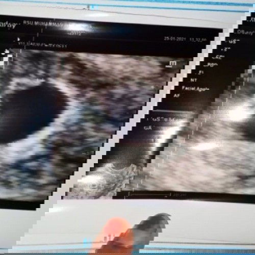 Bayi ku penyemangat ku