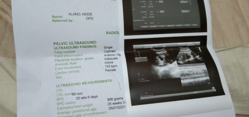 😞😞😞😌😊😊😊😊😊😊😊😊😊😊😊😊😊😊😊😊😊😊😊😊😊😊😊😊😊😊😊😊😊😊😊😊😅😊😅😊😅😅😊😅😅😊😅😅😅😅