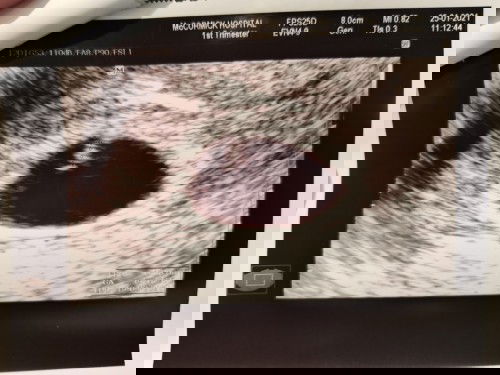 ช่วยดูหน่อยค่ะ