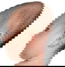 Kepala bayi lonjong dan datar usia 3 bulan apa masih bisa diperbaiki?