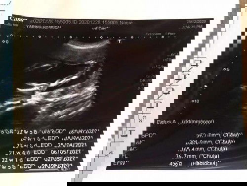 อยากรู้ว่าเพศอะไร มีใครพอรู้บ้างไหมค่ะ