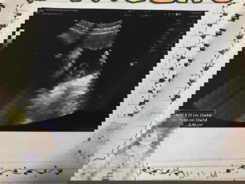 น้องไม่ยอมกับหัวทำไงดีค่ะ