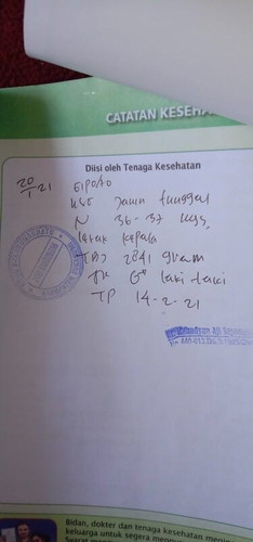 Posisi bayi sungsang.