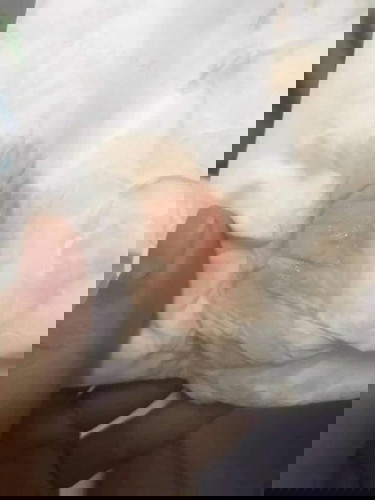 ตั้งครรภ์ 19วีค มีเลือดออกจากช่องคลอดเรื้อรัง